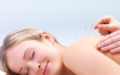 7 Real Facts To Know About Acupuncture Treatment