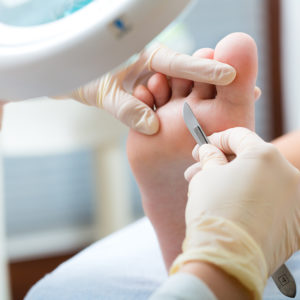 Nurturing Your Feet with Chiropody Treatment at Bramalea Physiotherapy and Wellness Centre