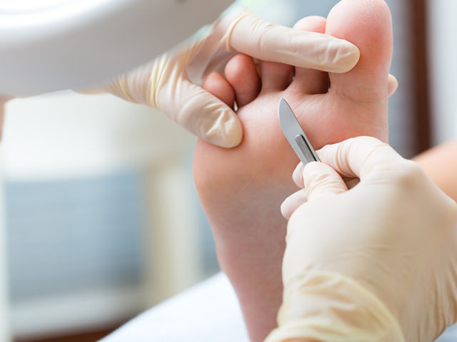 Nurturing Your Feet with Chiropody Treatment at Bramalea Physiotherapy and Wellness Centre