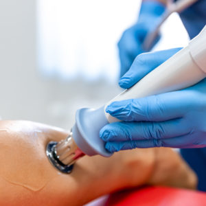 Harnessing the Power of Shockwave Therapy at Bramalea Physiotherapy