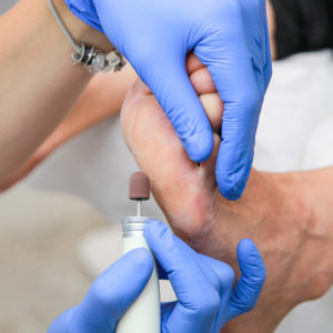 Comprehensive Chiropody Treatment in Brampton Your Path to Healthy Feet