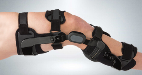 Custom Braces